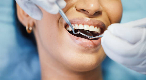 Best Emergency Broken Tooth Repair in Delphi, IN