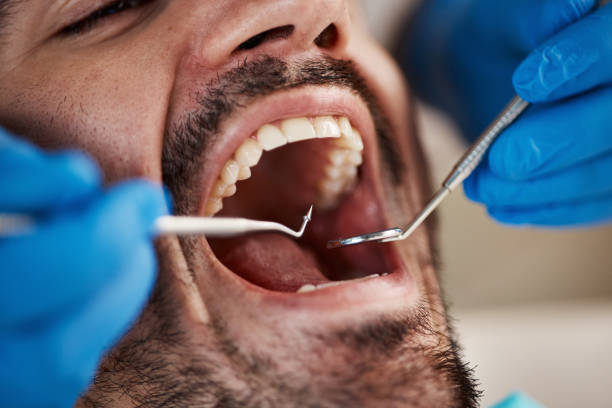 Best Emergency Tooth Extraction in Delphi, IN